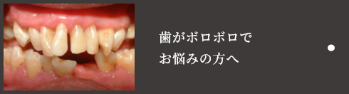 歯がボロボロでお悩みの方へ